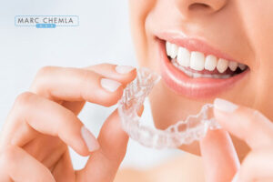 A Guide on Invisible Teeth Straightening by Dr. Chemla